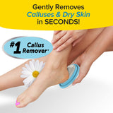 Ped Egg Classic Callus Remover, As Seen On TV, New Look, Safely and Painlessly